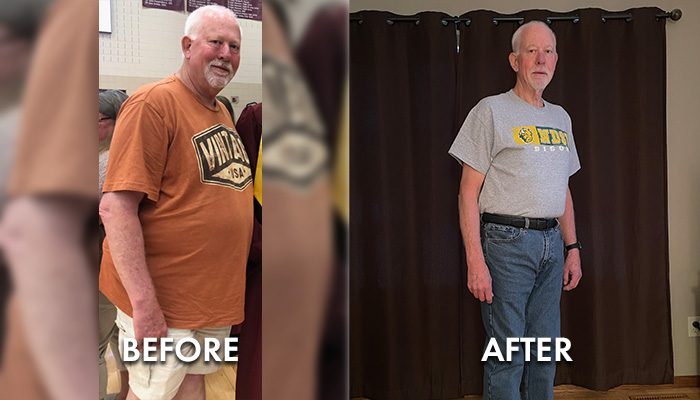Gary E. Before and After